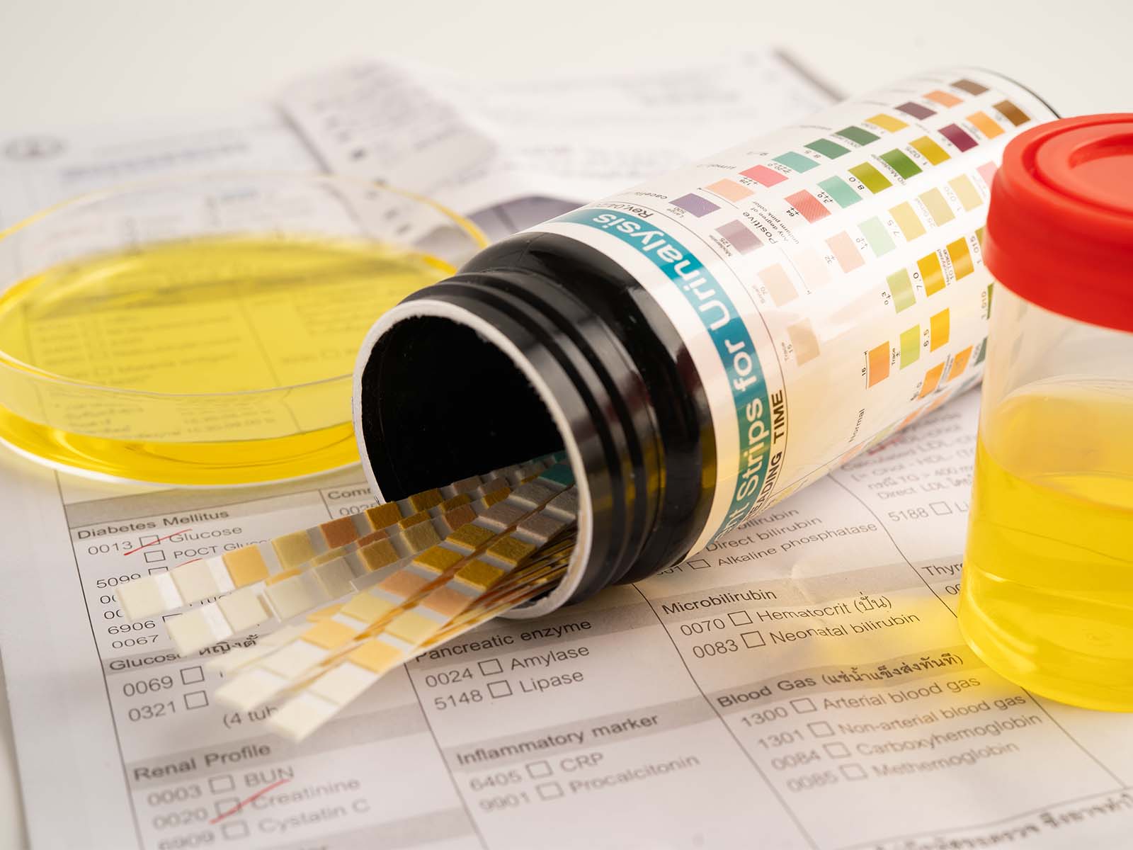 Urine